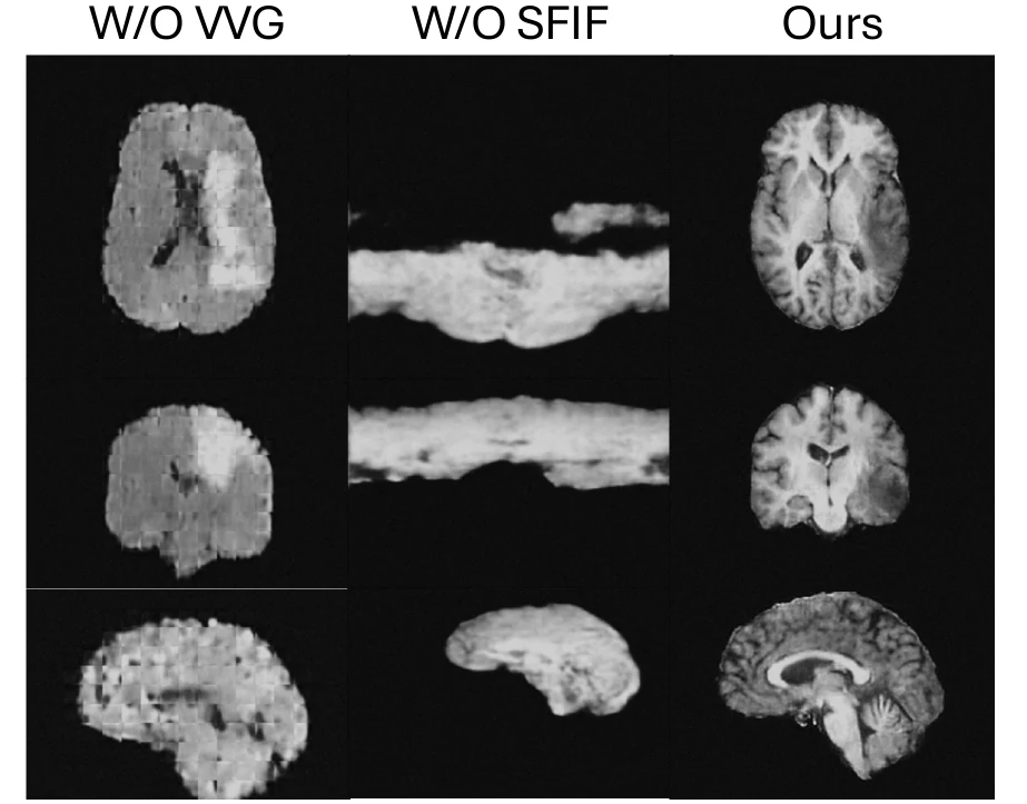 Ablation showing block artifacts without VVG and malformed anatomy without SFIF